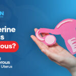 Are Uterine Fibroids Dangerous? Understanding Non-Cancerous Growths in the Uterus