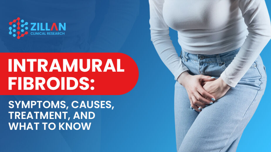 intramural Fibroids