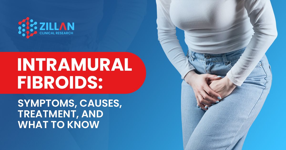 intramural Fibroids